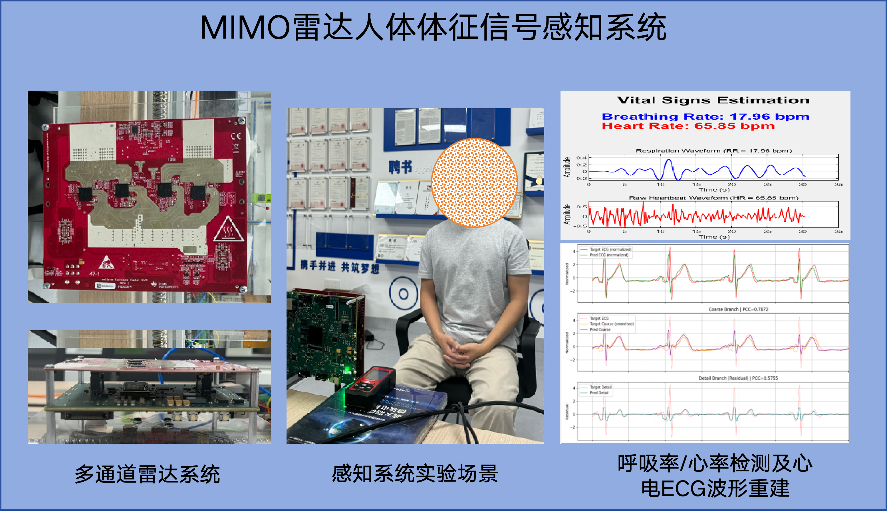 MIMO 雷达人体体征信号感知系统